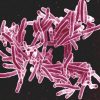 Preocupación por tuberculosis resistente a medicamentos en Suramérica