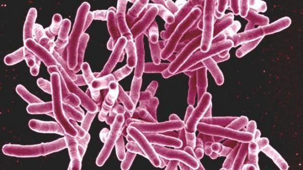 Preocupación por tuberculosis resistente a medicamentos en Suramérica