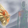 Perjeta incrementa la supervivencia global de las pacientes con cáncer de mama metastásico HER2 positivo en 16,3 meses