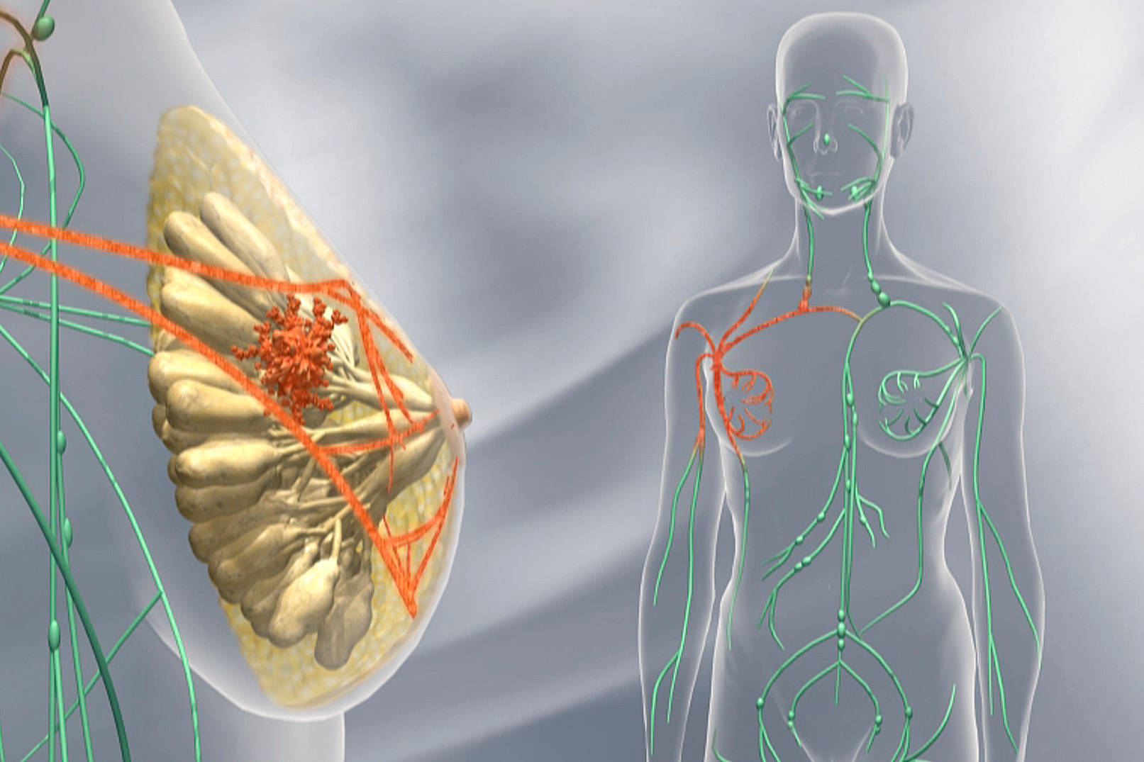Perjeta incrementa la supervivencia global de las pacientes con cáncer de mama metastásico HER2 positivo en 16,3 meses