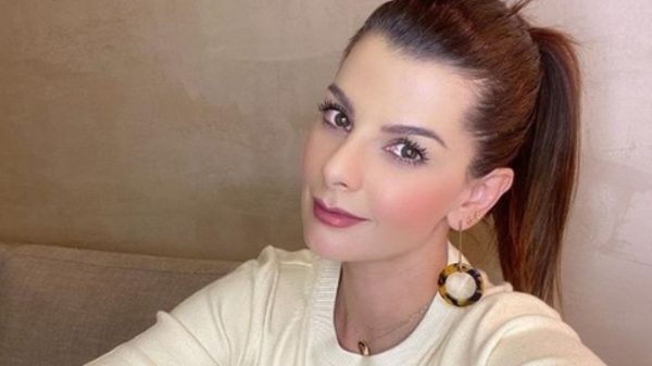 Carolina Cruz mostró los estragos del embarazo en la piel de su cara