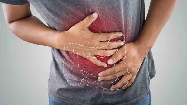 Colitis: Causas, Tipos, Diagnóstico Y Tratamiento Nación Farma: Salud y medicina para todos