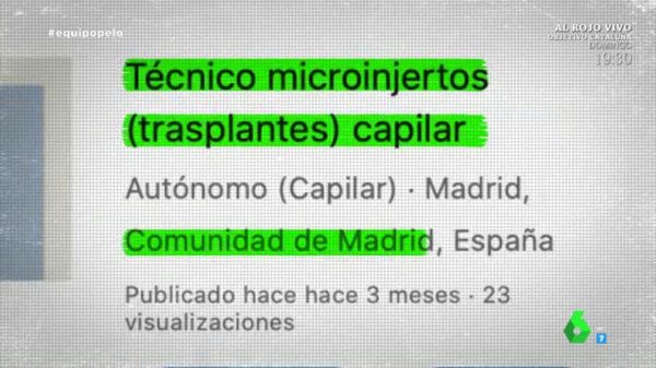 Técnico de injerto capilar, uno de los perfiles más solicitados en medicina estética: “Recibo más de 15 o