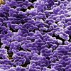 Covid: antibióticos para 3 de cada 4 ingresados
