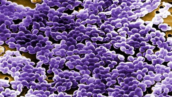 Covid: antibióticos para 3 de cada 4 ingresados