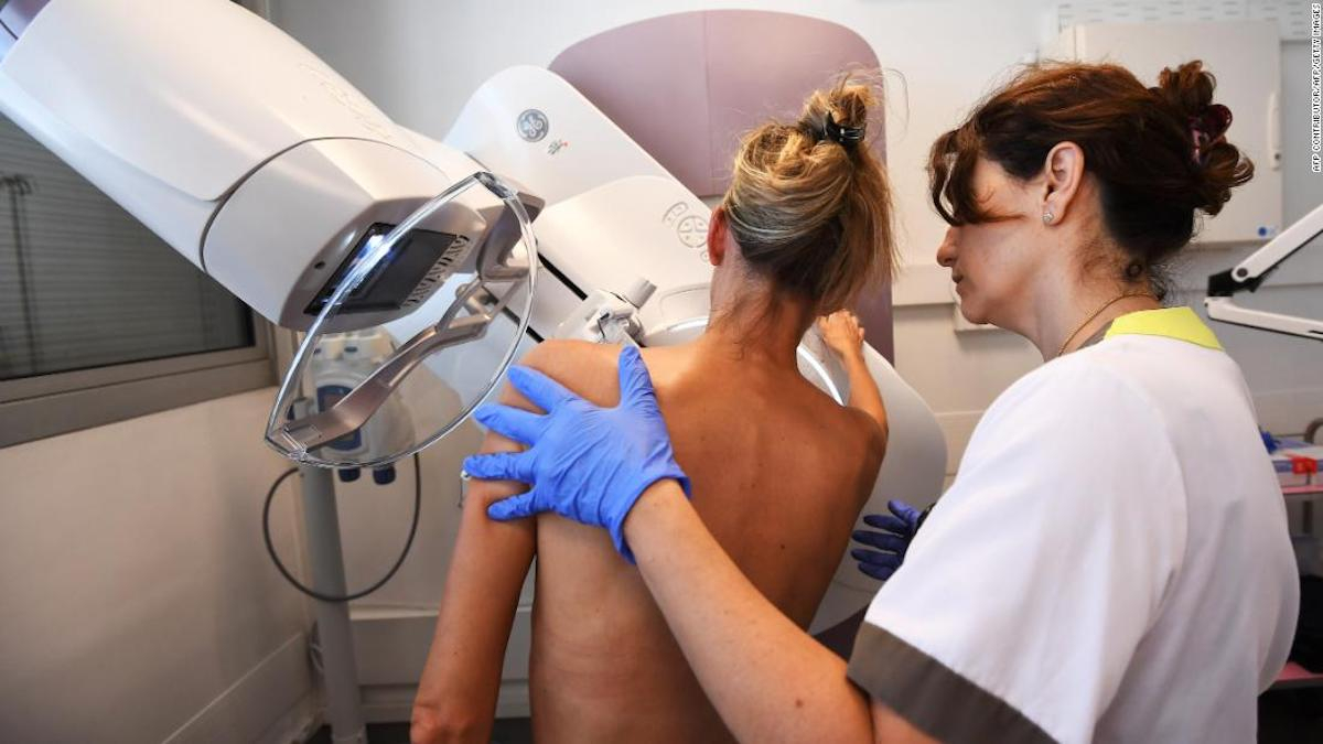 Mamografías detectan la hinchazón debido a la vacuna contra el covid-19 causando un miedo innecesario, dicen los radiólogos