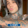 ‘Influencer’ Yeferson Cossío se puso implante de senos… por un reto