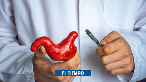 ¿Cuándo la cirugía bariátrica es respuesta para la obesidad?