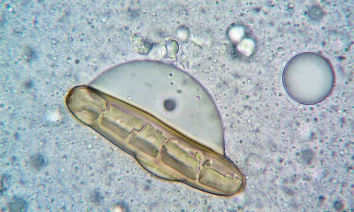 Juan David Ruiz Ramírez, patinador de 14 años, en plena acción sobre su patín en la pista de la Unidad Deportiva Alberto Gali