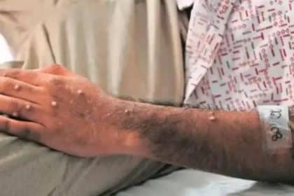 Un profesional de salud examina muestras en un laboratorio en Antioquia.